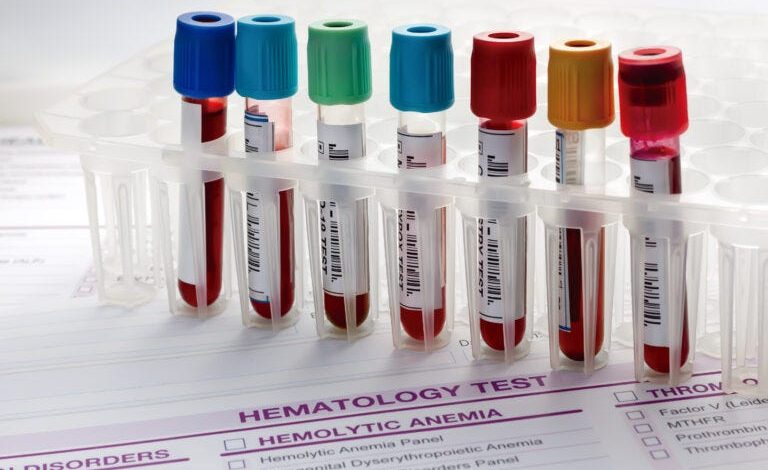 Ten Important Blood Tests Every Adult Needs Annually
